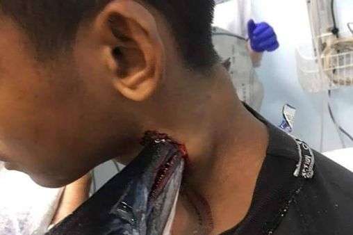 Teen impaled by needlefish after it jumped into boat and pierced through his neck