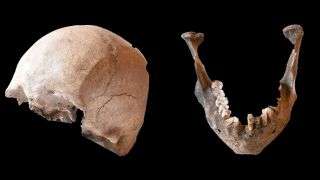 Pliny the Elder died in the Mount Vesuvius eruption of A.D. 79. Is this his skull?
