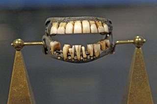 Dentures worn by George Washington are not made of wood, as one tale suggested. Here, they are on display at the N.C. Museum of History in Raleigh.