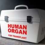 What happens to your body when you’re an organ donor?