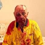 Pensioner, 84, left with blood pouring from head after being attacked outside home