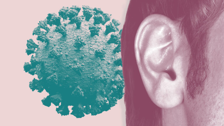 Coronavirus causes hearing loss