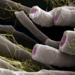 Gut Bacteria Imbalance Linked to Multiple Sclerosis