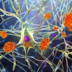 There's a new blood test for Alzheimer's disease. Here's everything you need to know about it.