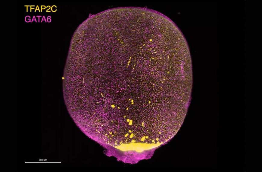 Scientists Grow Mini Amniotic Sacs in Lab Using Stem Cells