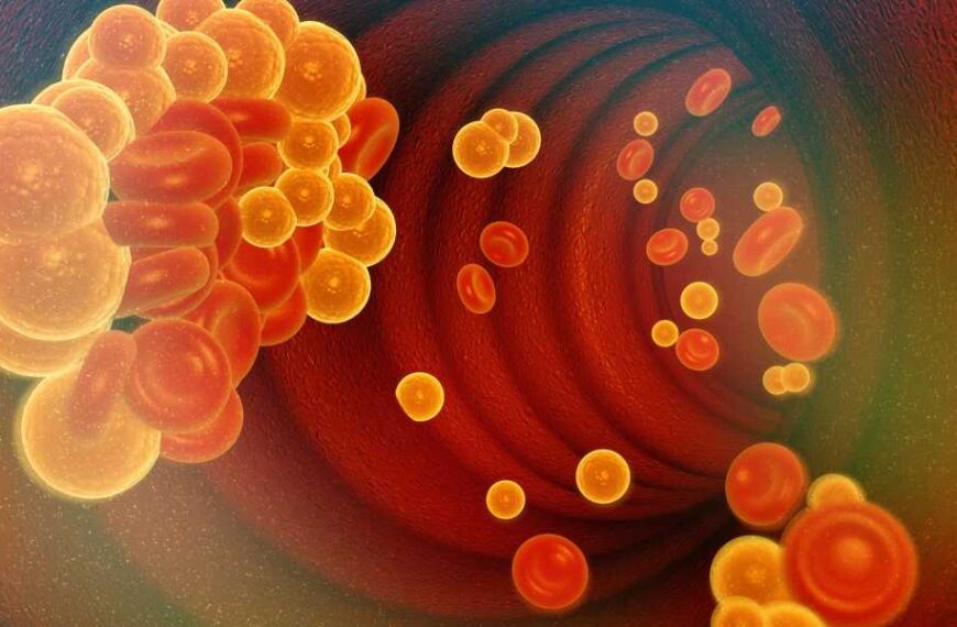 Experimental high cholesterol treatment edits DNA in the body to lower LDL levels