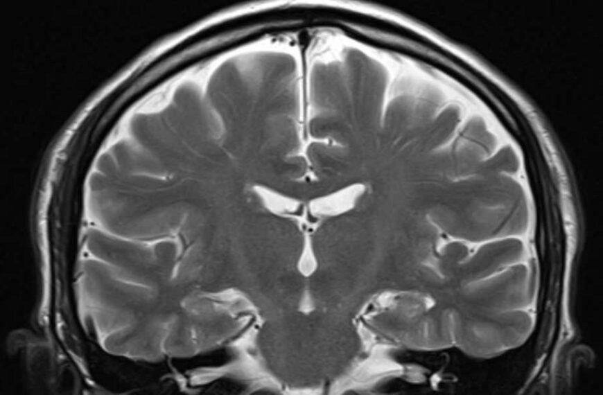 Scientists Claim One MRI Can Reveal How Fast You're Aging