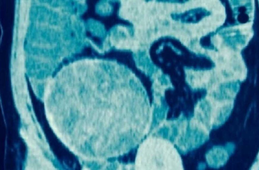 Diagnostic dilemma: Strange lump in woman's thigh turns out to be a sponge left over from a C-section.