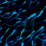 Diagnostic dilemma: Rare sperm allergy may have caused woman's infertility