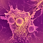 'Universal' cancer vaccine heading to human trials could be useful for 'all forms of cancer'