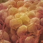 Losing weight can 'rejuvenate' fat tissue by getting rid of old cells