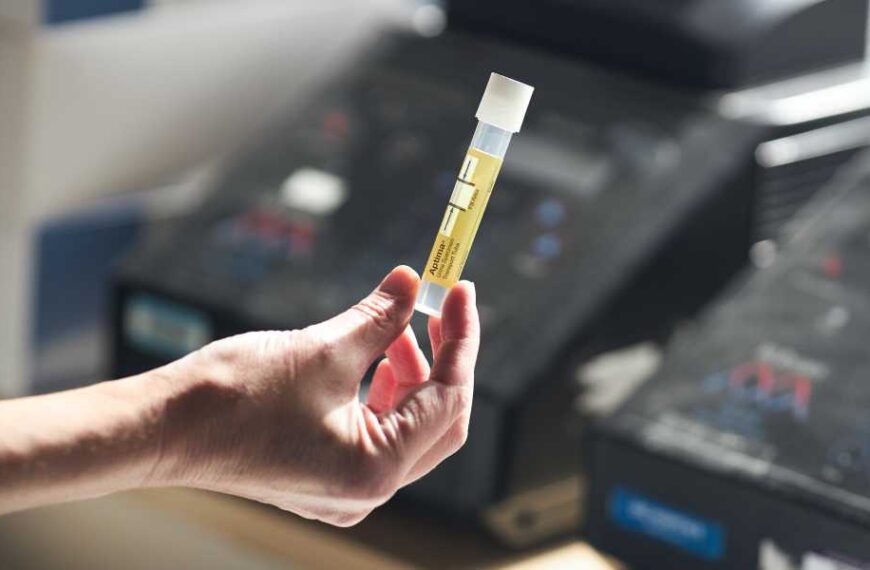 Scientists Turn Urine Into Material Suitable for Medical Implants
