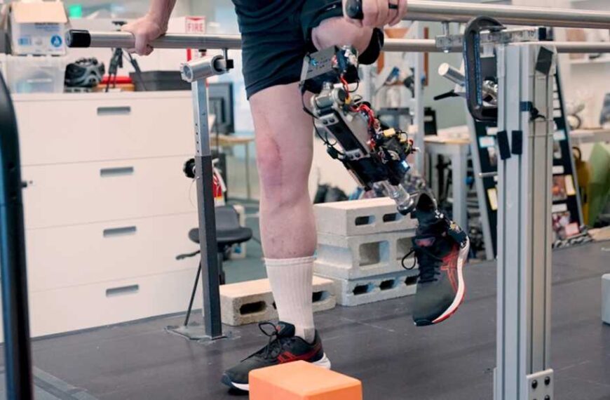 The new bionic knee connects directly to muscles and bones to provide a better feel for the user's body.