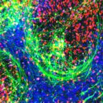 Pocket-Sized ALS Model Could Pave the Way for New Treatments