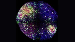 'Mini Brains' Reveal Secrets of Formation of Key Brain Cells in the…