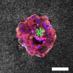 Incredible, first-of-its-kind video showing the implantation of a human embryo in real time.