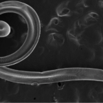 Diagnostic dilemma: Woman gets something in her eye – and it turns out to be parasitic worms.