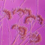 You may not be allergic to penicillin. Here's how to find out if you are.