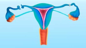 How does the tubal ligation procedure work?