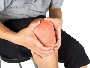A crunch in your knees isn't always arthritis: what this sound really…