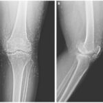 Diagnostic dilemma: Woman's severe knee pain suggests 'golden threads' in her joints