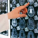 American scientists have discovered a protein that contributes to age-related memory decline
