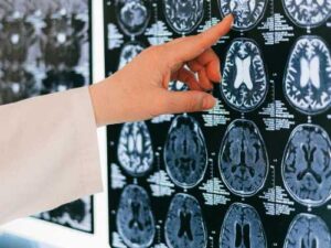 American scientists have discovered a protein that contributes to age-related memory decline