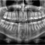 Teeth: Not Considered Bones – Here’s Why