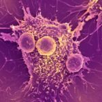 mRNA COVID vaccines may activate the immune system to identify and destroy…