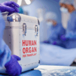 Scientists transplant a kidney from blood type A to the universal blood…