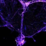 Brain drainage system damage: A possible cause of ‘chemo brain’.