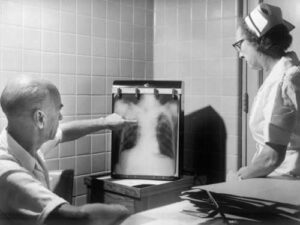 Ventilation is more important than you think: Study proves that tuberculosis DNA…