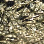 Chemotherapy impacts healthy cells along with cancerous ones. However, scientists believe that…
