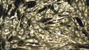 Chemotherapy impacts healthy cells along with cancerous ones. However, scientists believe that…