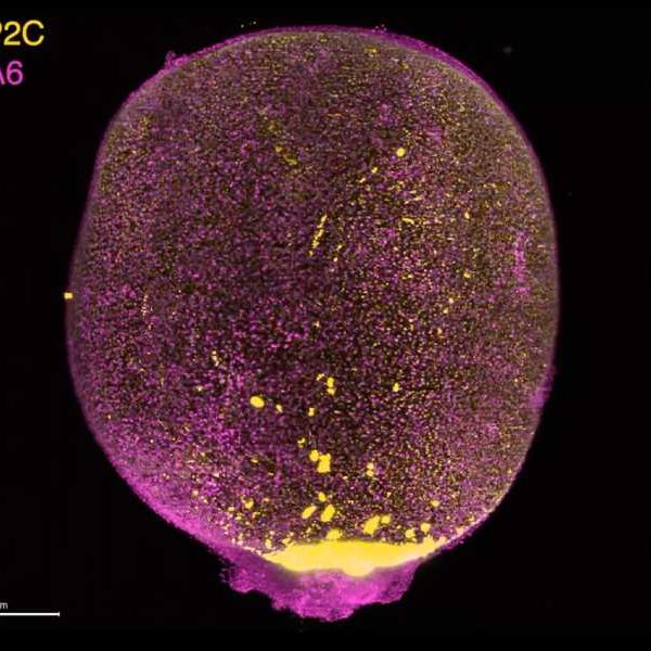Scientists Grow Mini Amniotic Sacs in Lab Using Stem Cells