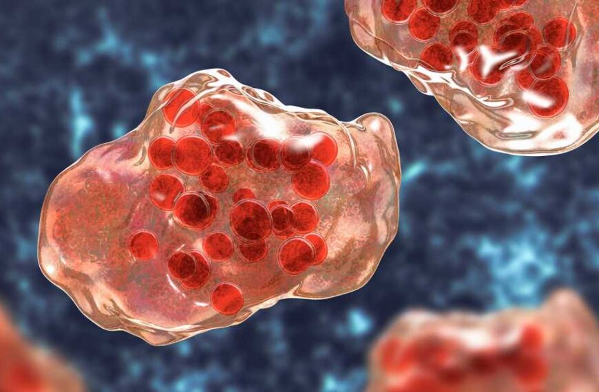 Two school-age children die in Texas measles outbreak, total cases exceed 480