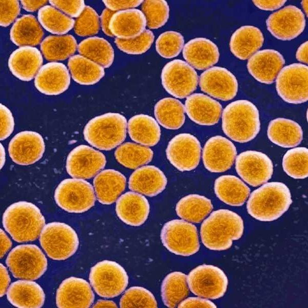 Superbugs are evolving inside the human body – tracking them in real…