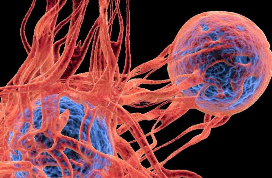 Simple blood test can reveal recurrence of deadly skin cancer, study shows