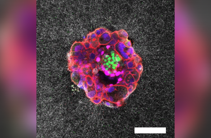 Incredible, first-of-its-kind video showing the implantation of a human embryo in real&hellip;