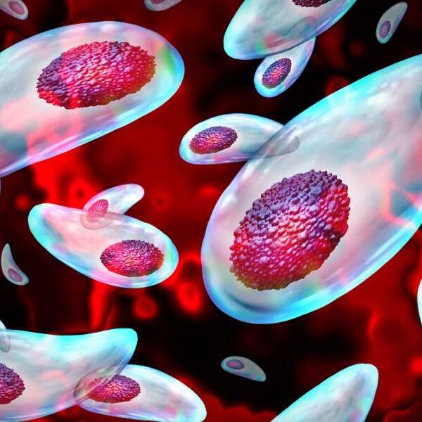 Common parasite decapitates human sperm