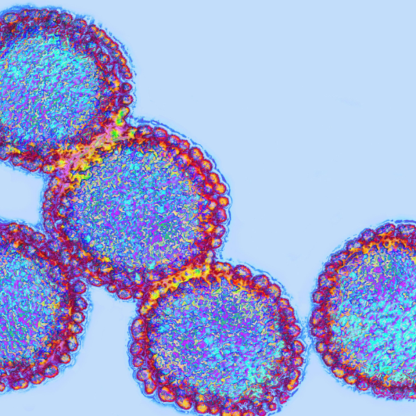 Flu: Facts About Seasonal Flu and Bird Flu