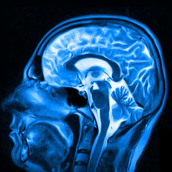 American woman dies of rare deadly prion disease after receiving contaminated injection…