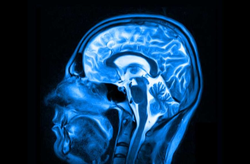 American woman dies of rare deadly prion disease after receiving contaminated injection…