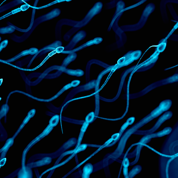Diagnostic dilemma: Rare sperm allergy may have caused woman’s infertility