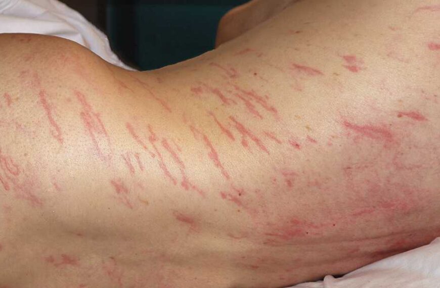 Diagnostic dilemma: Rash ‘migrated’ across man’s body from his anus
