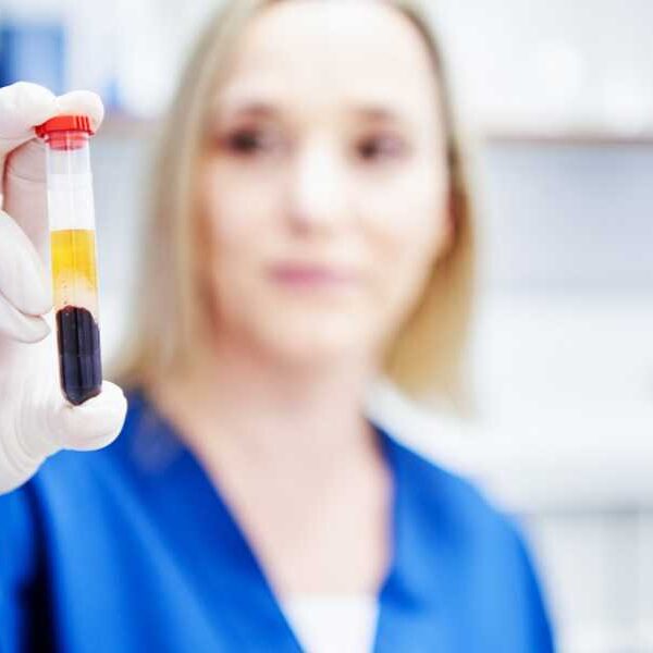 ‘Cancer fingerprints’ discovered after scientists blast blood samples with infrared light pulses