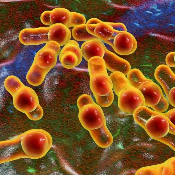 Diagnostic dilemma: Man’s fatal infection was caused by probiotic supplement