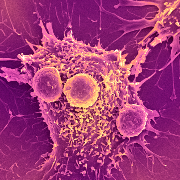 ‘Universal’ cancer vaccine heading to human trials could be useful for ‘all&hellip;