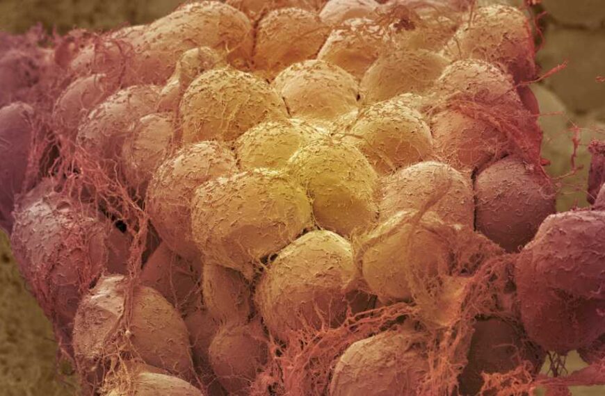 Losing weight can ‘rejuvenate’ fat tissue by getting rid of old cells