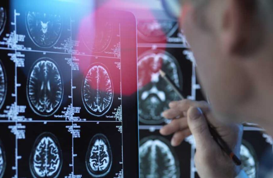 100% fatal brain disease hits 3 in Oregon